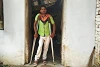 Choletal Mahato aus dem indischen Bundesstaat Jharkhand ist körperlich stark beeinträchtigt. Er ist dankbar, dass er dank der Hilfe von CSI eine Hühnerzucht betreiben kann (csi)