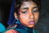 Die 13-jährige Savita Madkami wurde vom Hindu-Mob zusammengeschlagen, als sie ihre Tante retten wollte (wwm)
