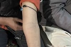 Die vielen Narben an Tabeetas linkem Arm zeugen von der schweren Misshandlung. csi